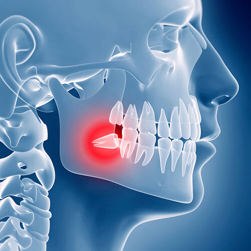 Орална хирургия